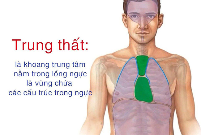 U trung thất Triệu chứng và cách điều trị sao cho hiệu quả GHV Ksol