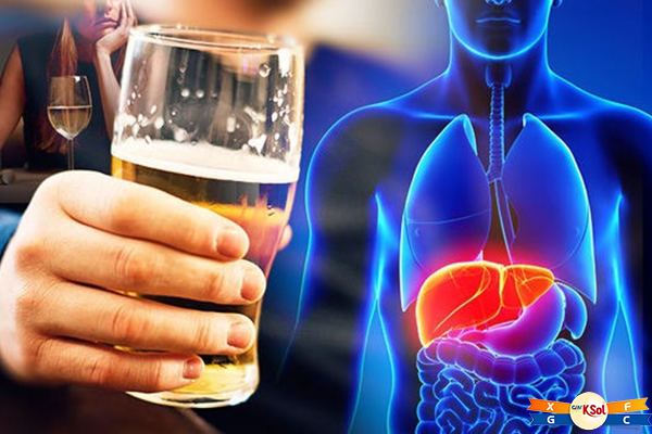 Bia rượu là 1 trong những nguyên nhân gây bệnh ung thư gan