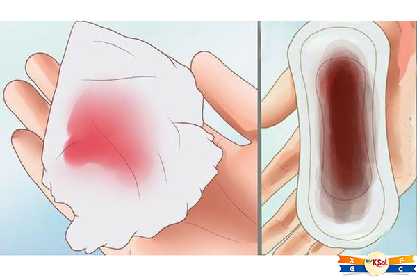 Tăng tiết dịch âm đạo có màu sắc bất thường là 1 trong những triệu chứng không thể bỏ qua của ung thư cổ tử cung