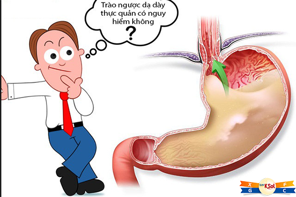 Nguyên nhân nào gây ung thư thực quản