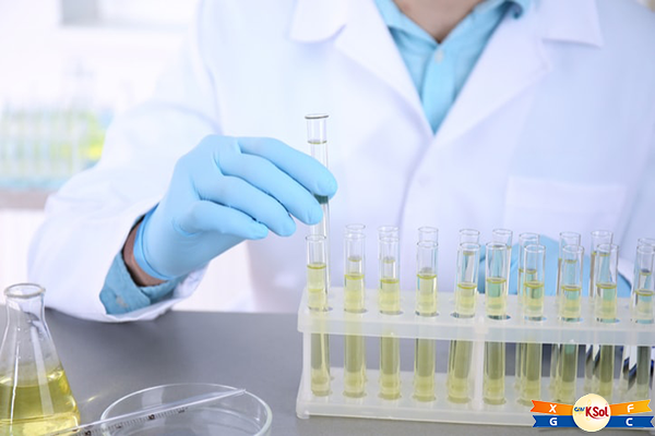 Xét nghiệm nước tiểu để chuẩn đoán bệnh ung thư bàng quang