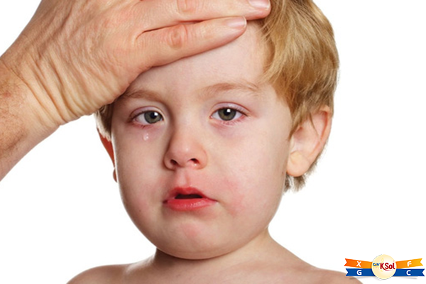 Bị nhiễm trùng và sốt là 1 trong những biểu hiện của bệnh ung thư máu ở trẻ em cần lưu ý