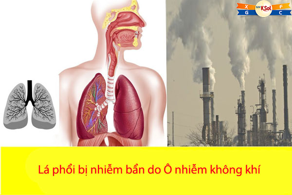 Tiếp xúc với không khí ô nhiễm lâu ngày có thể tích tụ nhiều chất độc hại