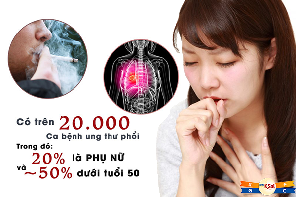 Ung thư phổi ở nữ giới và nguyên nhân ít ai ngờ tới
