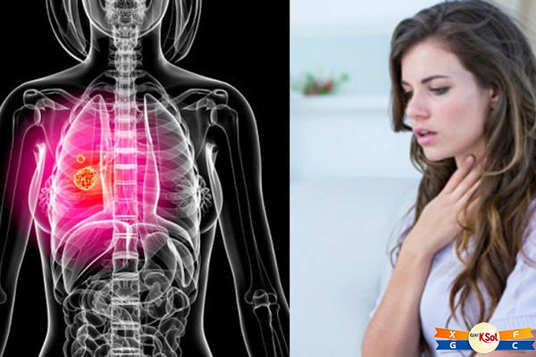 Yếu tố làm tăng nguy cơ ung thư phổi là gì?
