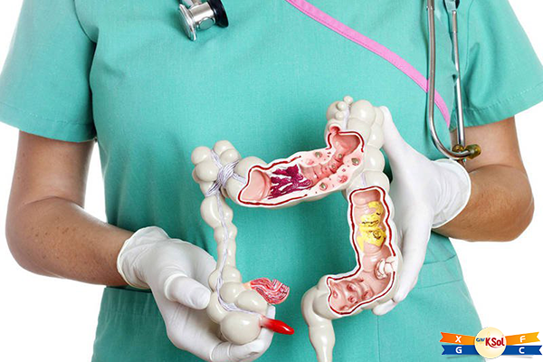 Phương pháp điều trị ung thư đại tràng
