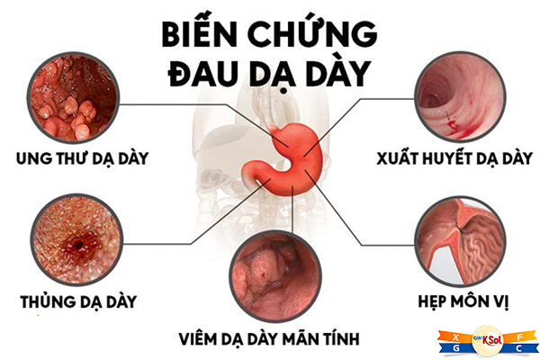 trieu-chung-cua-benh-dau-da-day-co-the-ban-dang-chu-quan (2)