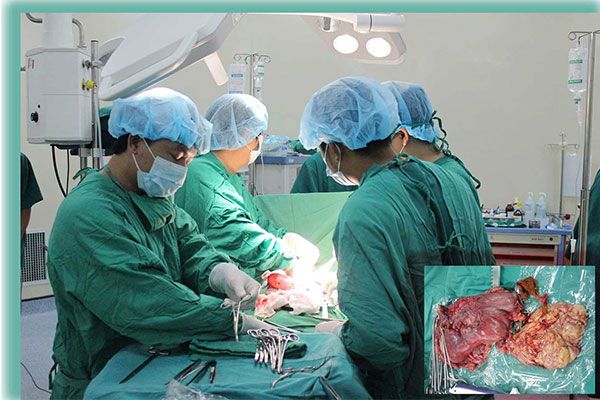 Phẫu thuật là phương pháp điều trị dạ dày ở giai đoạn cuối