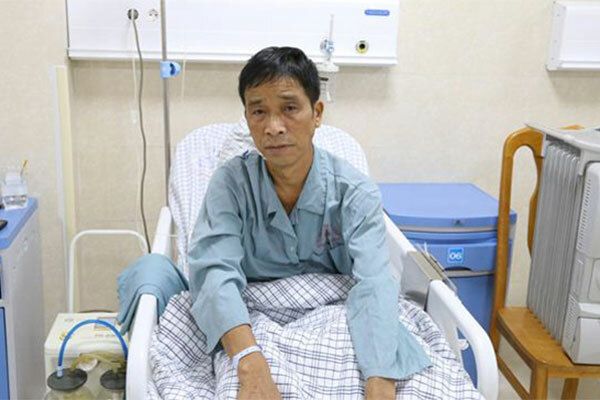 Xạ trị ung thư phổi khiến cho bệnh nhân mệt mỏi