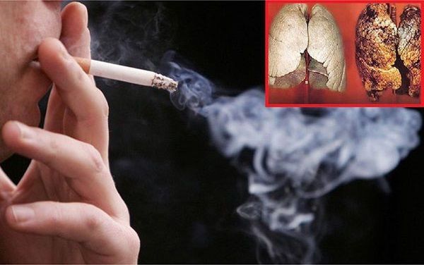 Bệnh nhân mắc ung thư phổi tuyệt đối không được hút thuốc lá
