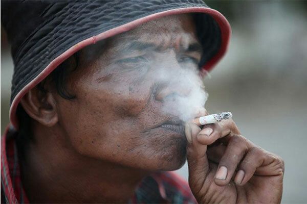 Hút thuốc lá làm tăng nguy cơ gây ung thư vòm họng