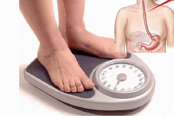 Sụt cân nhanh chóng là triệu chứng ung thư thực quản giai đoạn 3