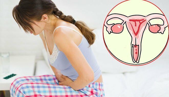 Ra máu âm đạo bất thường báo hiệu ung thư cổ tử cung