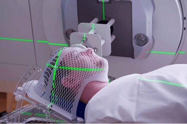 Ung thư vùng đầu và cổ thường được chỉ định bằng phương pháp xạ trị
