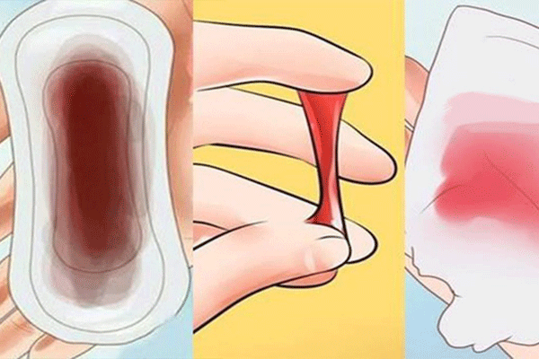 Chảy máu âm đạo bất thường là một trong những dấu hiệu cảnh báo mắc ung thư cổ tử cung