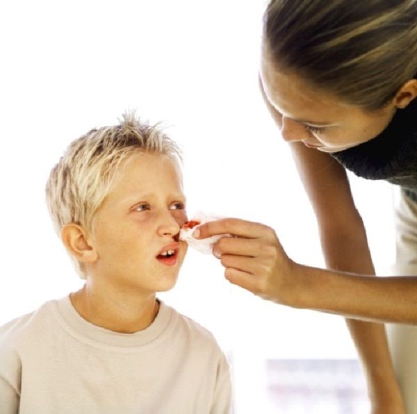 Chảy máu cam là biểu hiện phổ biến của ung thư máu