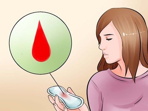 Xuất huyết âm đạo bất thường là một trong những dấu hiệu ung thư cổ tử cung