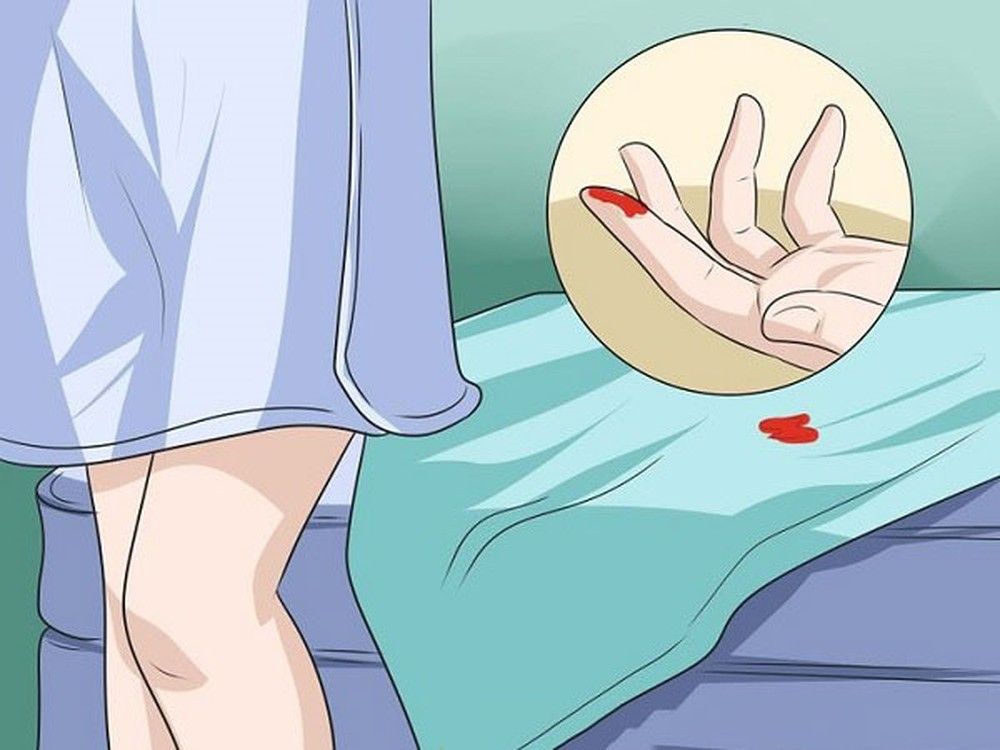 Xuất huyết âm đạo không rõ nguyên nhân là một trong những triệu chứng ung thư cổ tử cung