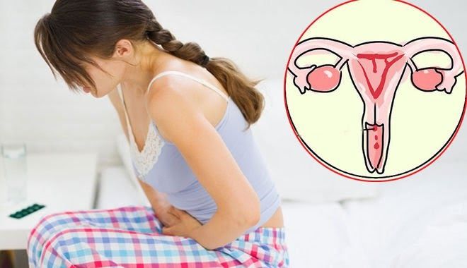 Ung thư cổ tử cung gây nguy cơ tử vong cao ở phụ nữ
