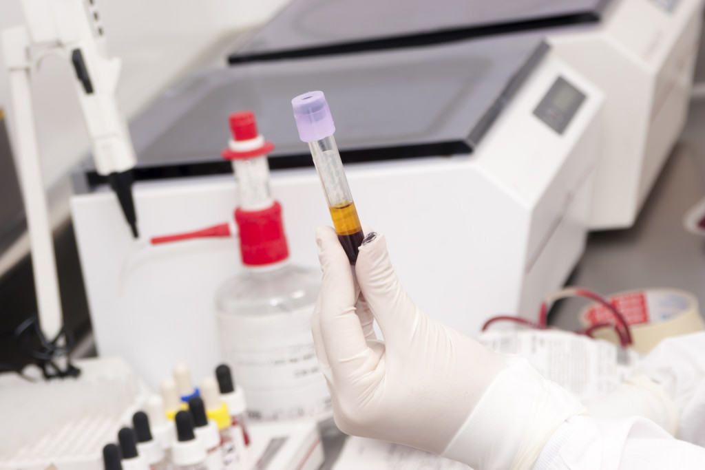 Xét nghiệm Pap Smear giúp phát hiện ung thư cổ tử cung giai đoạn đầu