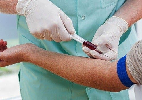 Xét nghiệm máu tìm dấu ấn ung thư PSA giúp chẩn đoán sớm ung thư tuyến tiền liệt