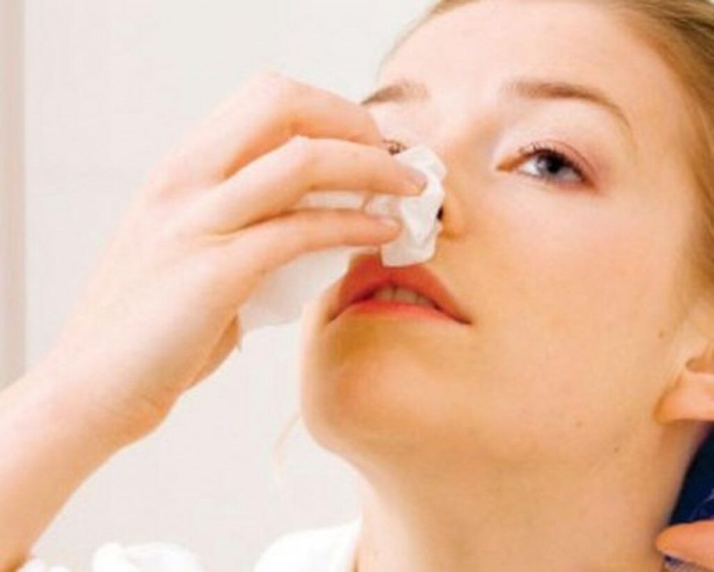 Thường xuyên chảy máu cam là một trong những dấu hiệu ung thư máu.