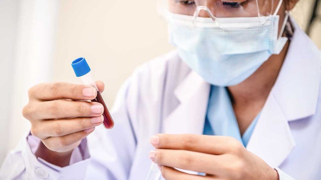 Xét nghiệm máu là phương pháp chẩn đoán ung thư gan
