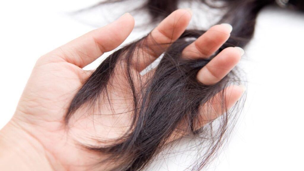 Rụng tóc là một trong những tác dụng phụ hóa trị liệu ung thư dạ dày thường gặp