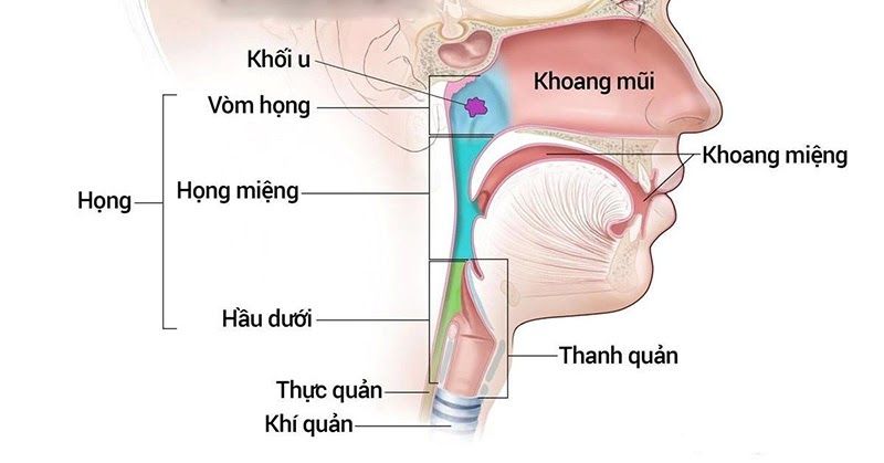 Ung thư vòm họng hay còn được gọi là ung thư mũi hầu xảy ra khi các tế bào ung thư phát triển từ các mô trong mũi hầu
