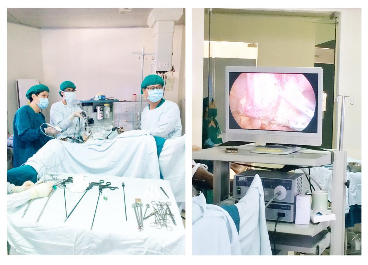 Cắt đại tràng là một trong các phương pháp phẫu thuật ung thư đại tràng
