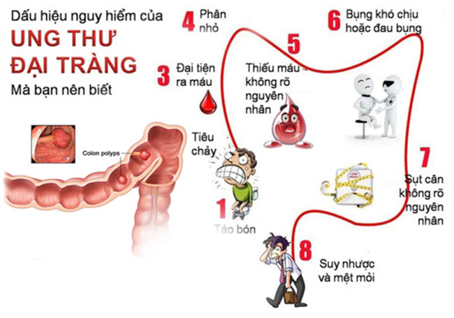 benh-ung-thu-dai-trang_13