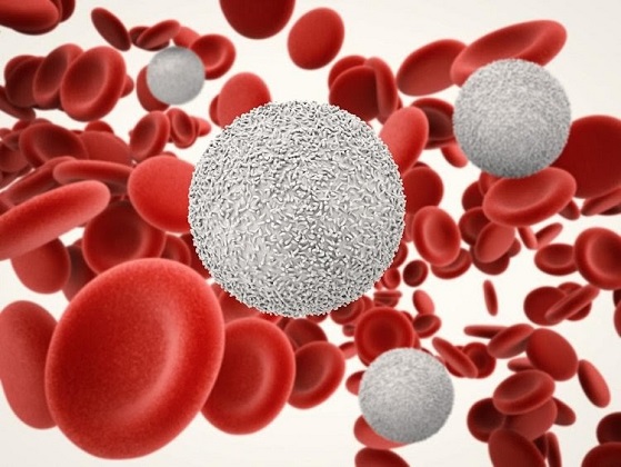 Tìm hiểu ung thư máu m3 là gì Triệu chứng và phương pháp điều trị