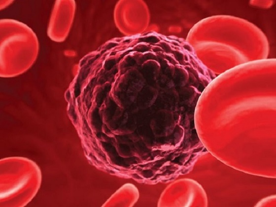 Có bằng chứng nào cho thấy ung thư lây truyền qua đường máu không?  
